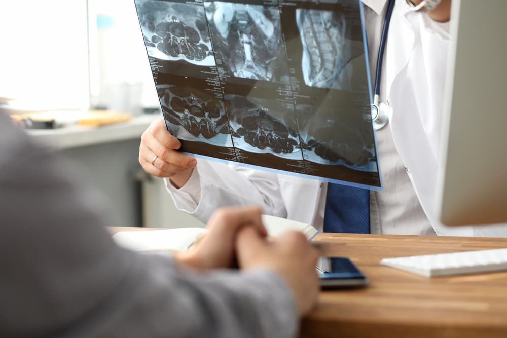 Doctor looking at mri data